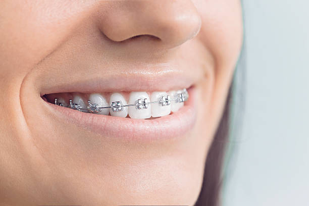 Best Teeth Whitening  in Madisonville, KY
